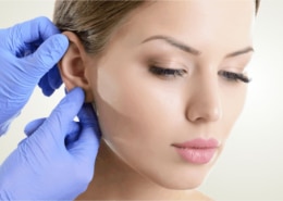 Cirurgia Plástica de Orelha